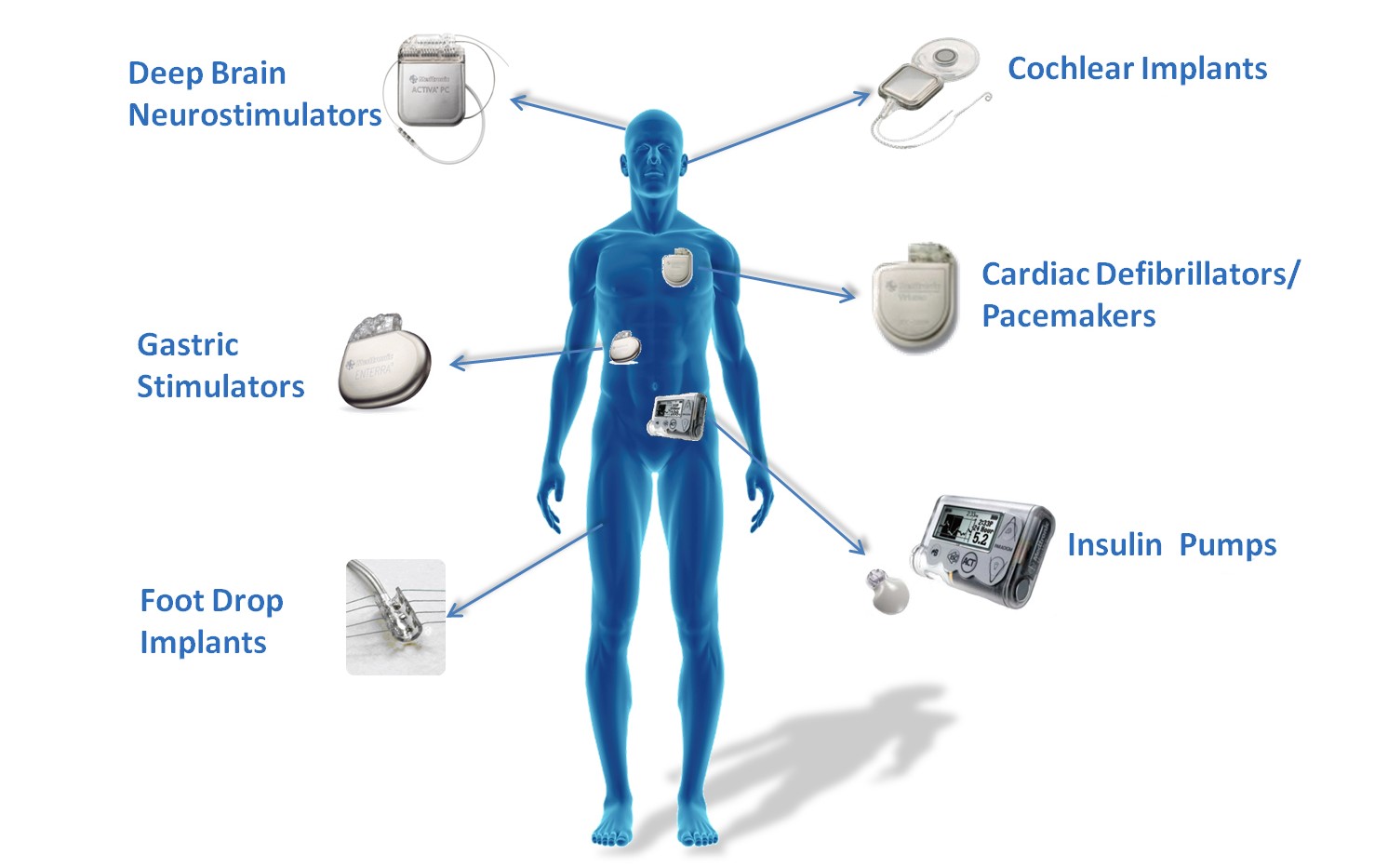 Implantable-medical-devices_graphic_WHITE